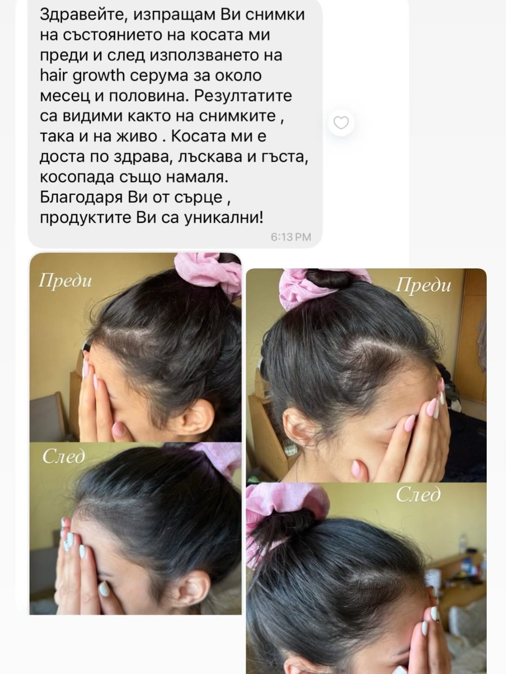 Hair Growth - Масло за бърз растеж и възстановяване